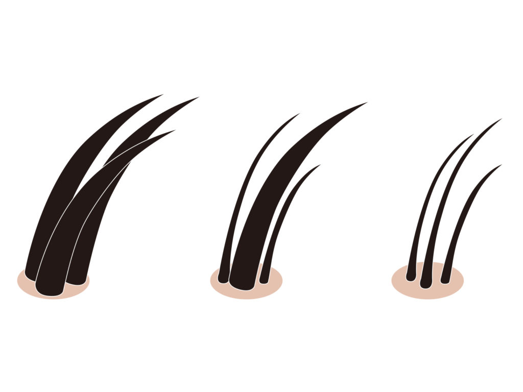 %e9%ab%aa%e3%81%ae%e6%af%9b